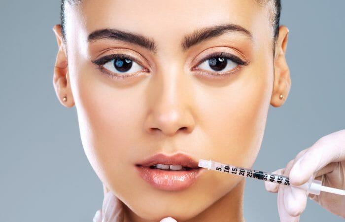 Lip Flip Treatment at Rejuvenate - Fillers and Botox Southampton