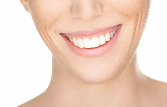 Gummy Smile Treatment - Fillers and Botox Southampton
