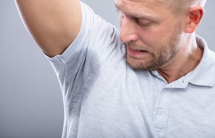 Excessive Sweating Treatment Southampton - Fillers and Botox