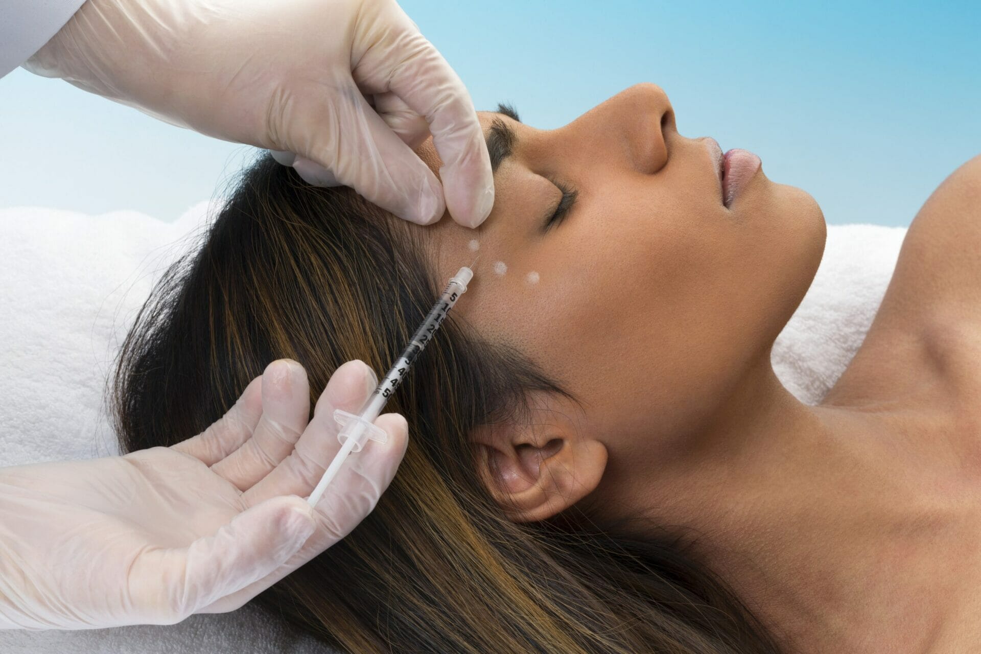 Botulinum Toxin Treatment - Fillers and Botox Southampton